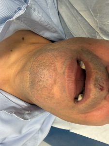 הנהג הפצוע באשפוז, צילום: כח לעובדים