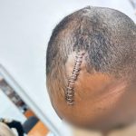 פצעי הדקירה בראשו של ר'. צילום: דוברות המשטרה